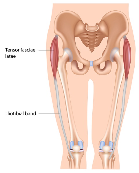 Anatomy diagram of the iliotibial band and the tensor fascia latae.