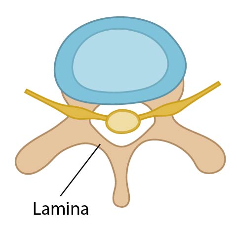 The boney part in the posterior or back part of the vertebra, called the lamina.