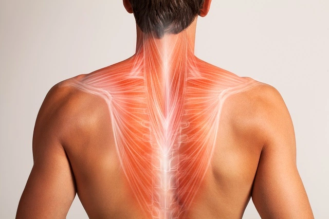 The trapezius muscle.