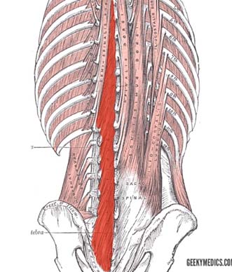 picture of the multifidus muscle along the spine