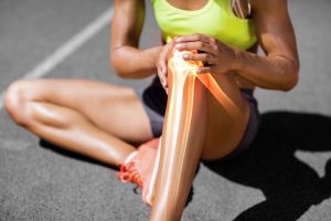 A woman with a knee injury from running.